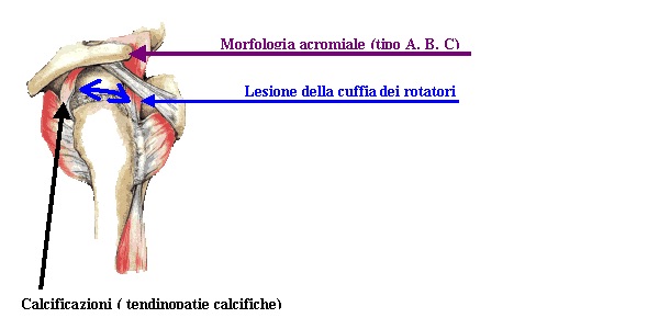 periartrite3