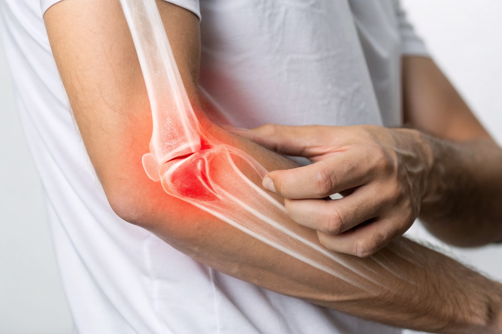 Elbow Pain Illustration with X-Ray Highlighting Tendonitis – Medical Concept Image for Injury and Joint Issues Gomito del golfista: cos’è e come trattarlo