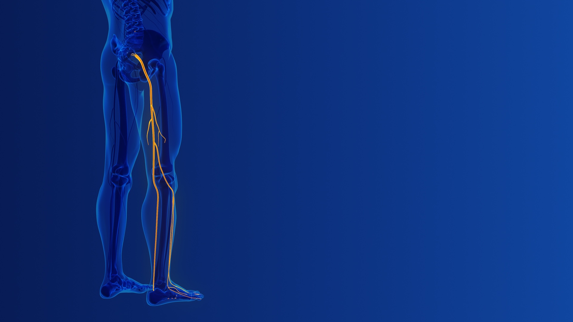 piriforme infiammato Sciatica o piriforme infiammato?